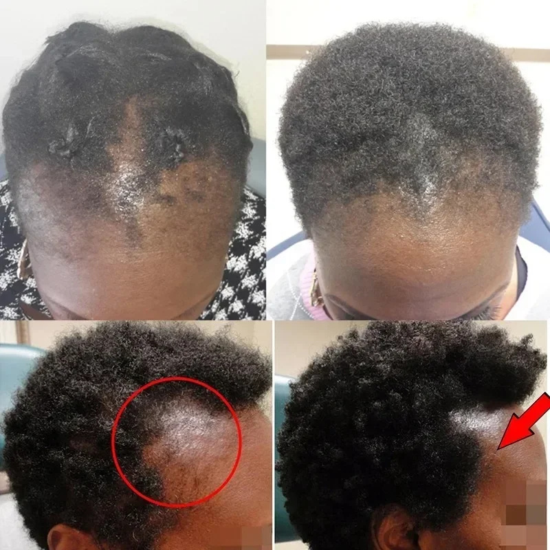 Batana Hair Growth Oil Conditi - Bond Repair Shampoo 评论和价格