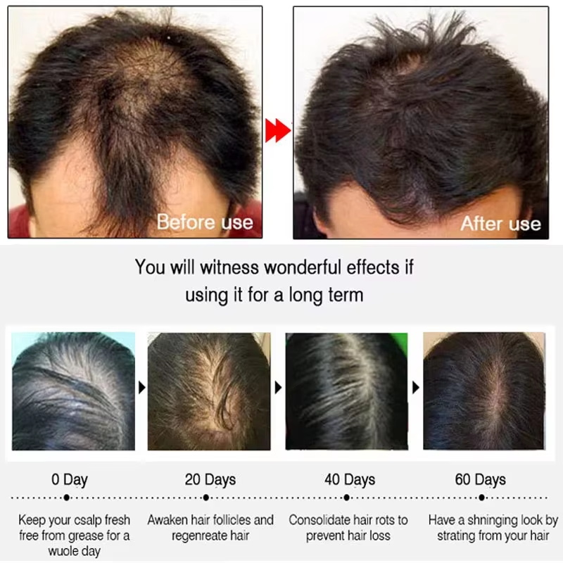 Fast Ginger Hair Growth Spray  - Hair Care With Protein 评论和价格